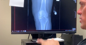 X-ray