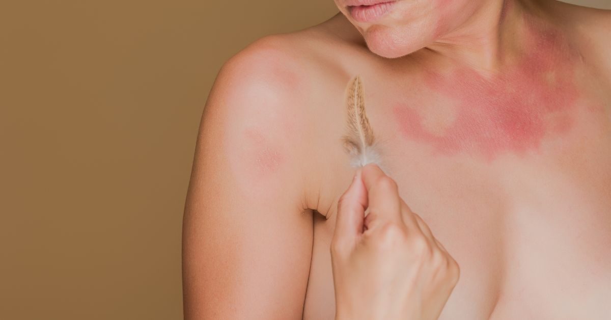 Why Your Allergies Are Worse This Year in Edwardsville: What to Know (and What Actually Helps)
