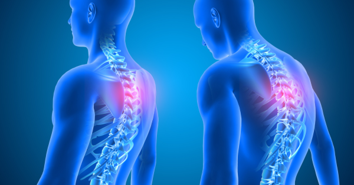 back pain causes