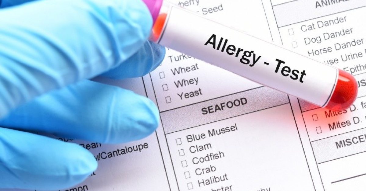 food allergy 2